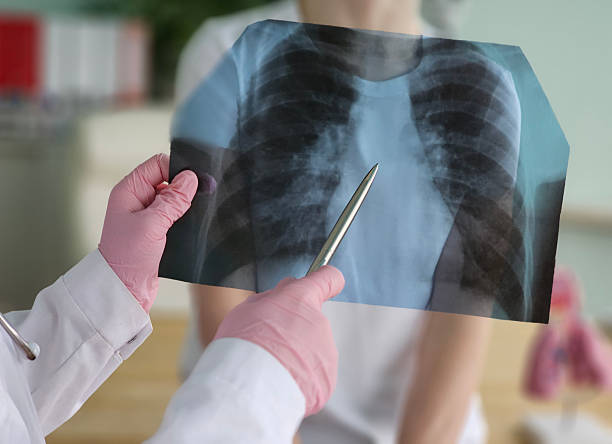 Asthma Clinical Trials: Advancing Treatment and Improving Quality of Life